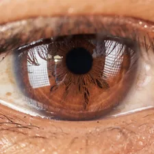 persons eye with black and brown eye related to Coverlet Eye Occlusor