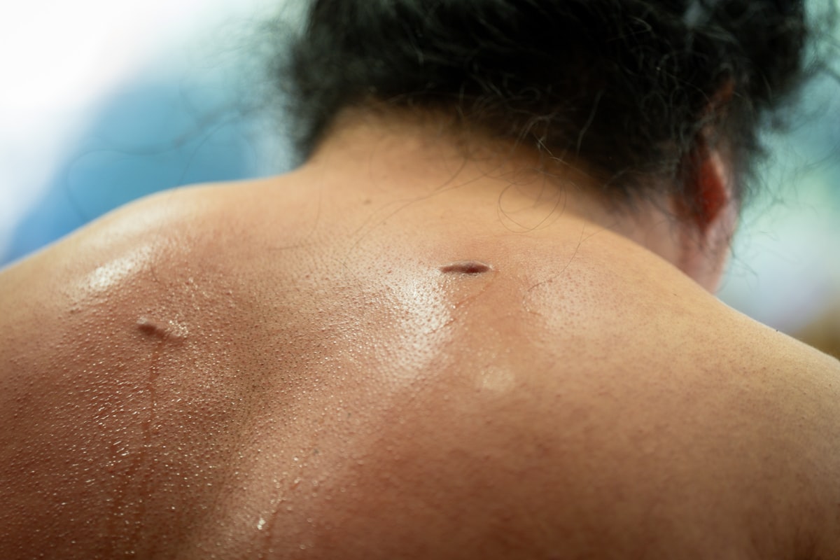 Sweaty neck of a sumo wrestler during practice related to The Itchy Truth About Bed Bug Bites: What You Need to Know
